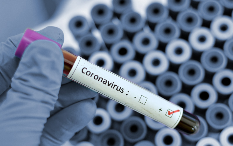Coronavirus in the Media: Mapping the Discussion around Biotech and Pharma