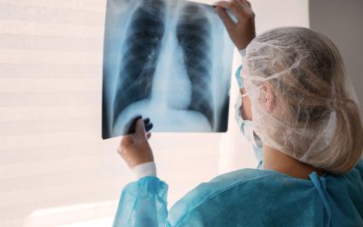 Rebranding lung cancer: pharma’s role in breaking stigma and boosting awareness